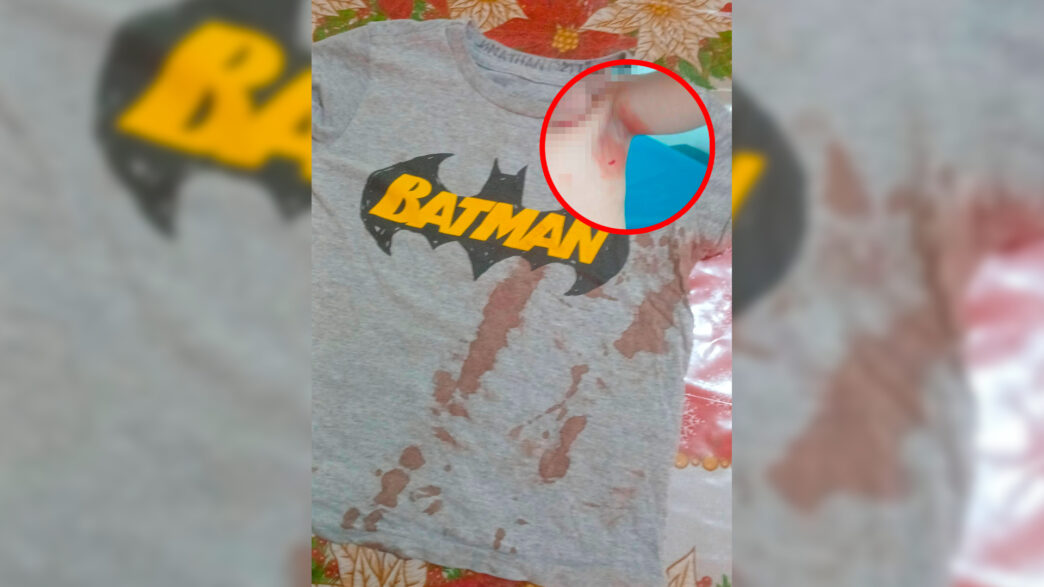 Explota termómetro de mercurio y lesiona a niño en kínder de Ciudad Valles