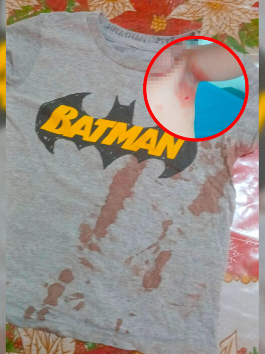 Explota termómetro de mercurio y lesiona a niño en kínder de Ciudad Valles